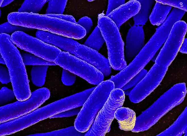 E. coli чаще всего вызывает цистит у женщин